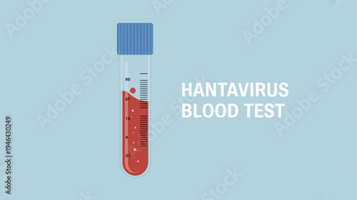 Hantavirus blood test tube with red liquid and blue cap on light blue background for medical diagnosis