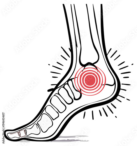 Foot Pain Illustration Showing Ankle Injury and Discomfort Highlighting Potential Medical Issues with Bone and Joint Condition