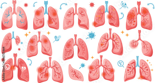 Human lungs medical vector set showing respiratory diseases, infection, inflammation and breathing problems, detailed anatomy illustrations for healthcare education and medical awareness