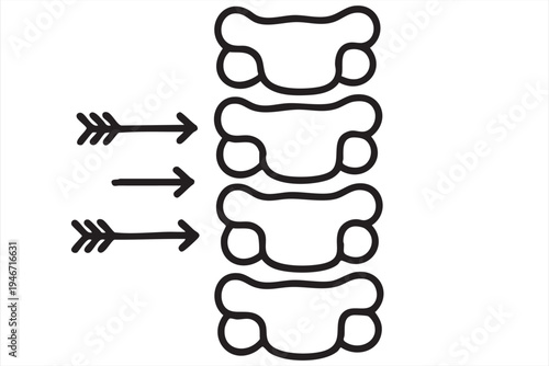Spine disc herniation line icon with vertebrae and pressure arrows for orthopedics neurology chiropractic care back pain diagnosis and spinal treatment graphics