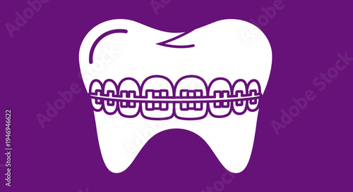 Orthodontic Treatment: Simplified Illustration Of Dental Braces And A Tooth on Purple Background
