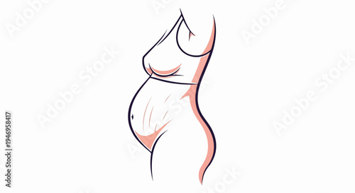 Side profile illustration of a pregnant woman's torso, showing a baby bump and stretch marks