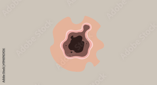 Abstract illustration of a skin lesion or mole with irregular borders and varied dark tones on a light background