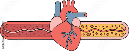 Human heart illustration, healthy blood vessel, atherosclerosis concept, cardiovascular health diagram, medical wellness design, circulatory system art, healthcare education