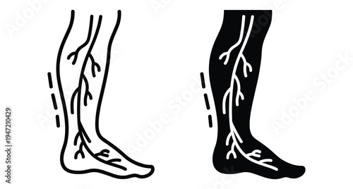 Varicose veins medical icon set showing human leg with swollen blood vessels for vascular disease diagnosis and treatment health care