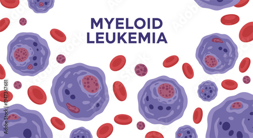 Myeloid Leukemia medical illustration with abnormal white blood cells and red blood cells, cancer awareness concept.