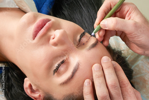  plastic surgeon and young woman with correction lines before cosmetic surgery, drawing lines on eyes