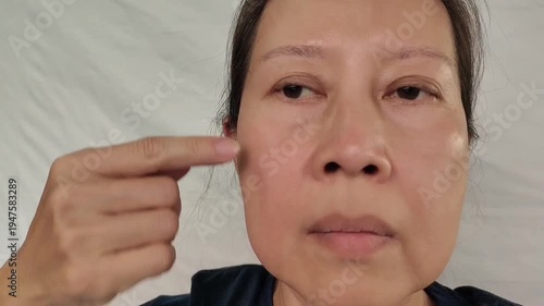 portrait the fingers holding the flabbiness adipose sagging skin, smile lines beside the mouth, Flabby skin and loose, scar, emotion and expression on the face, health care and beauty concept 