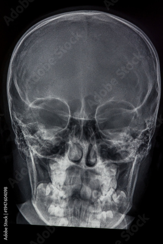 Картината върху платно An X-ray image of a human skull, providing a clear view of the bone structure