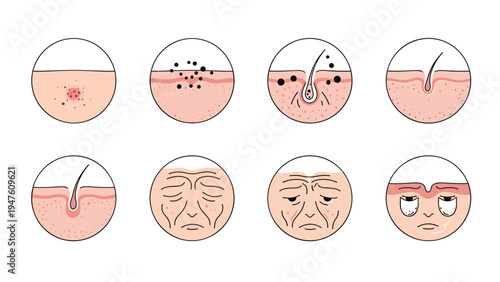 Illustrations of various human skin conditions and facial aging signs like acne, wrinkles, and hair follicle structures in circular views.