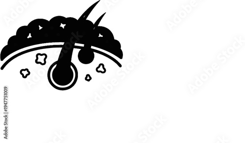 Stylized illustration of a hair follicle with surrounding skin layers