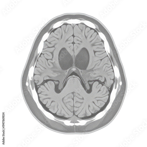 Human Brain Axial MRI Scan Cross Section Image On White