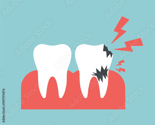 Two teeth on red gum, one healthy and one broken with pain lightning, on a light blue background representing dental issue