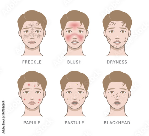 acne, acne scar, acne type, aesthetic, allergic, allergy, appearance, avatar, beauty, black head, blackhead, blemish, blush, burn, character, comedo, condition, cosmetic, dermatology, dry skin, drynes