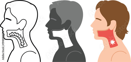 Minimalist thin line vector illustration of human profile showing throat pain area with spark symbol and anatomical neck.
