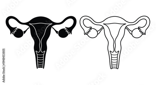 Diagram of the female reproductive system showing uterus and ovaries