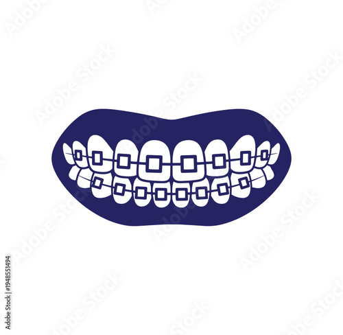 Teeth with metal braces on dental model for orthodontic treatment and dental care