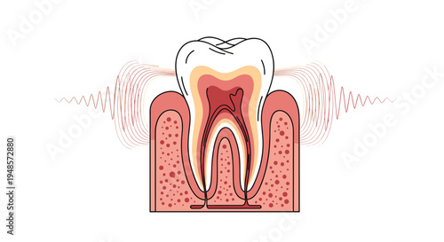 Cross section of a human tooth showing internal anatomy and pulp surrounded by vibrating red lines representing toothache and dental pain.