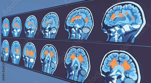 Brain scan images show different areas of activation in various conditions and tests over time