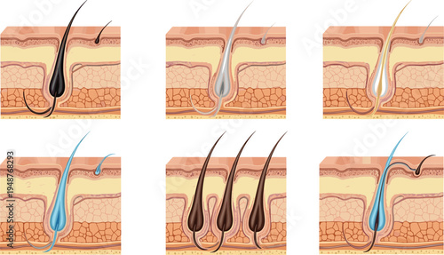 Human hair follicle structure and growth cycle stages diagram, scalp anatomy medical illustration showing hair development phases