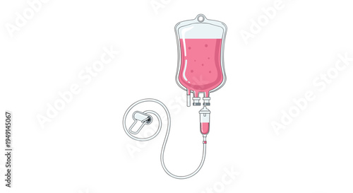 A single clear plastic IV bag filled with vibrant pink liquid is connected to a drip chamber and coiled tubing.