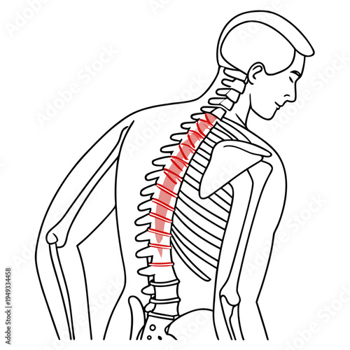 A vector graphic illustration of a man's back with a highlighted spine and red markings indicating pain or injury