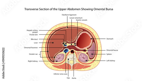 Transverse Section of the Upper Abdomen Showing Omental Bursa, Cross-sectional anatomical diagram of the upper abdomen highlighting the liver, stomach, spleen, kidneys, major vessels, and the omental 