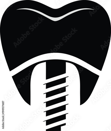 Dental Implant Silhouette Icon with Screw and Crown Detail for Oral Surgery and Restorative Dentistry