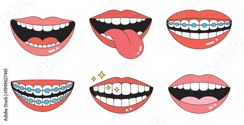 Cartoon lips illustration set, colorful mouth expressions with teeth, tongue, braces and smiling female characters playful vector collection.