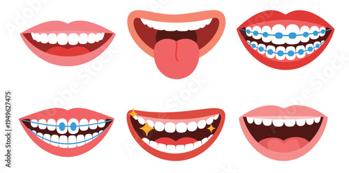 lips mouth expression set illustration, colorful vector mouths with teeth tongue braces and smiling female characters for comic character design.