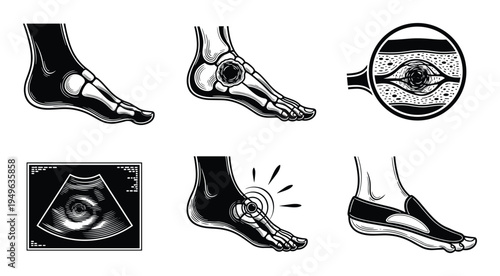 Foot anatomy and medical diagnosis vector illustration, set showing bones, joints, and pain points