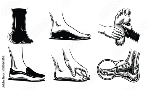 Set of foot health and care illustrations, depicting massage, flat feet, shoe inserts, and toe issues