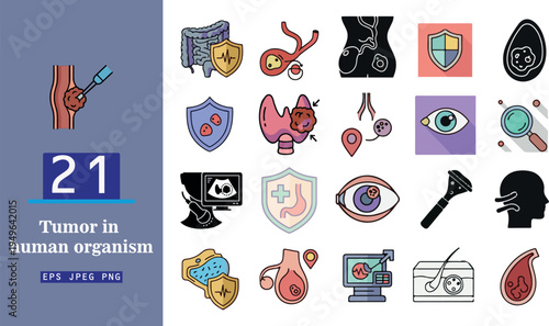 This comprehensive graphic collection showcases a wide variety of medical icons depicting tumors and their presence within the human organism covering crucial aspects of oncology diagnosis prevention 
