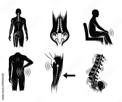Spinal cord and back pain diagnostics vector set with sciatica and posture issues
