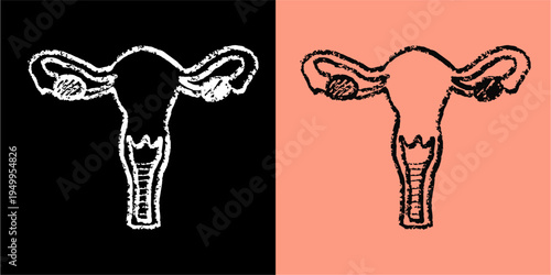 Set editable chalk drawing uterus vector for medical biology classes. Ideal for symbolizing vintage anatomy studies, chalkboard women's health, and maternity lessons.
