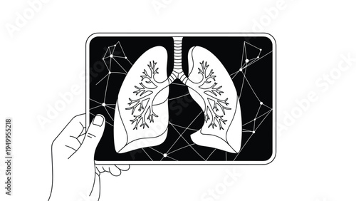 Hand holds a digital medical x-ray of human lungs integrated with a glowing network of complex data points and nodes.