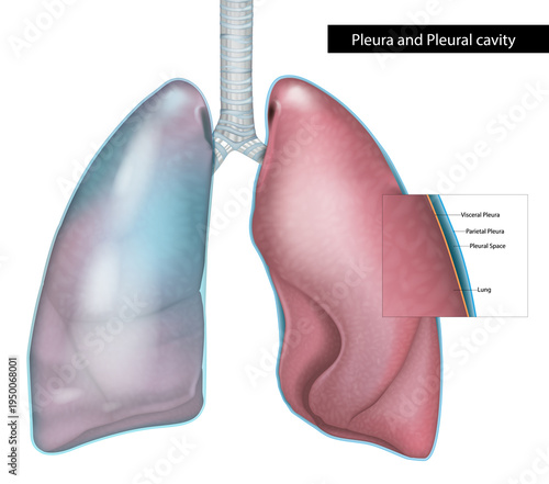 Detailed medical illustration of the human lungs showing the pleura and pleural cavity structure. Visceral pleura, parietal pleura, and pleural space