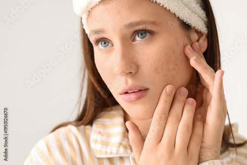 Young woman with acne probl...