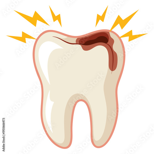 Tooth cavity or dental caries vector isolated illustration medical oral health design perfect for dentistry education awareness concept and healthcare themed artwork