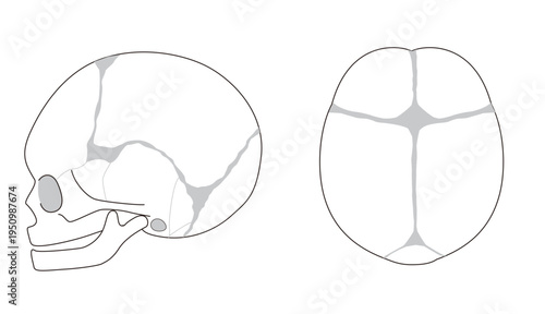 Infant skull anatomy diagram showing cranial sutures and fontanelle, top and side view