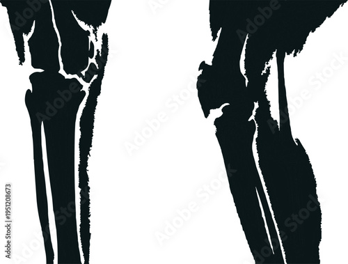Two parts of an artistic or graphic representation of the bones of the human foot are shown.