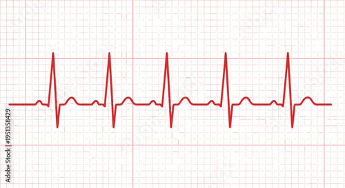 Electrocardiogram heartbeat line on medical monitor grid illustration, cardiology heart rhythm signal isolated on white background for healthcare, medicine and emergency concept