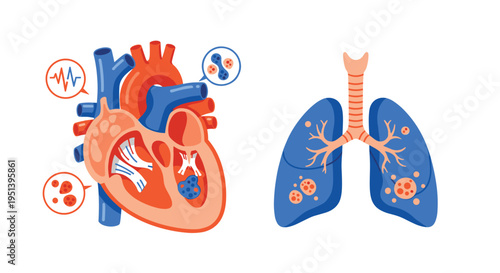 A medical illustration shows a red and blue human heart with internal structures and cell clusters alongside blue lungs with orange cell clusters.