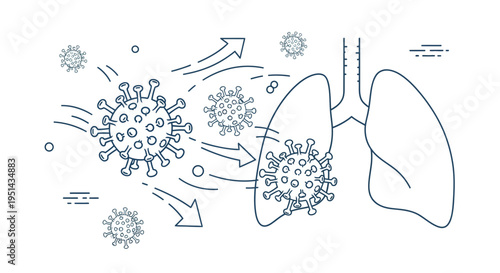 Coronavirus attacking lungs, respiratory system infection, virus spread illustration