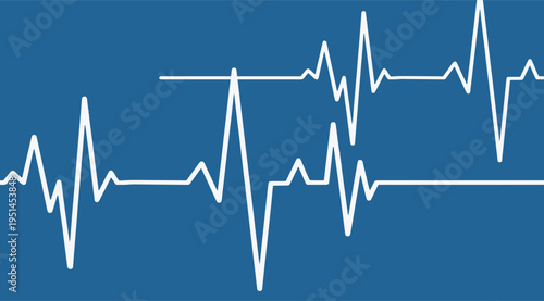 White heartbeat waveform on blue background, a jagged line illustration for medical health data technology concept