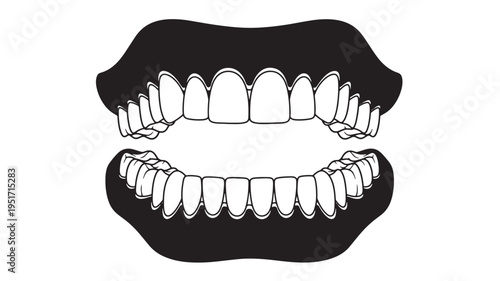 Teeth set in black silhouette with white outlines on a white background, showing upper and lower jaws.