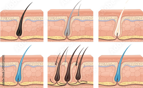Hair follicle anatomy cross section set, human skin layers diagram, hair growth cycle stages, dermatology medical illustration, and scalp health treatment vectors.