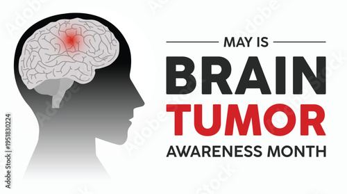 May is Brain Tumor Awareness Month (also known as Brain Cancer Awareness Month or "Gray May"), dedicated to supporting patients, funding research, and raising awareness about brain tumors