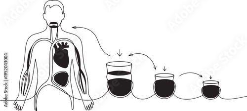 A critical condition associated with a significant deficit in arterial blood volume. A simple diagram of the development of hypovolemic shock. One line draw graphic design vector