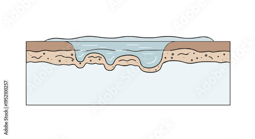Illustration of a skin wound showing the epidermal and dermal layers with a fluid-filled blister and underlying tissue damage
